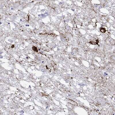 Immunohistochemistry: 5-HT7 Antibody [NBP2-68957]