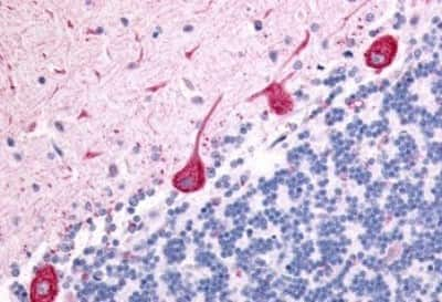 Immunohistochemistry-Paraffin: 5-HT7 Antibody [NBP3-14527]