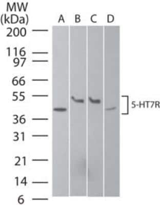 Western Blot: 5-HT7 Antibody [NB100-56352]