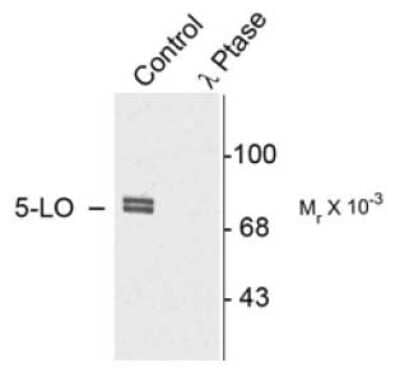 Western Blot: 5-Lipoxygenase [p Ser523] Antibody [NB300-277]