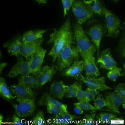 Immunocytochemistry/ Immunofluorescence: 5-Lipoxygenase Antibody - BSA Free [NB110-58748]