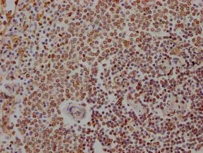 Immunohistochemistry: 5-Lipoxygenase Antibody (1D4) [NBP3-15171]