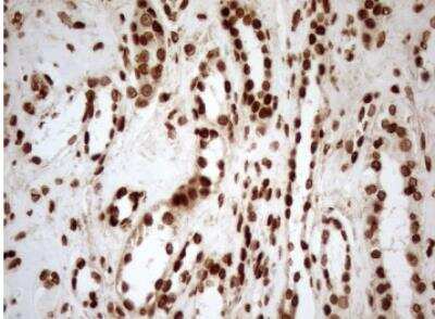 Immunohistochemistry-Paraffin: 5-Lipoxygenase Antibody (OTI3F1) [NBP2-46513]