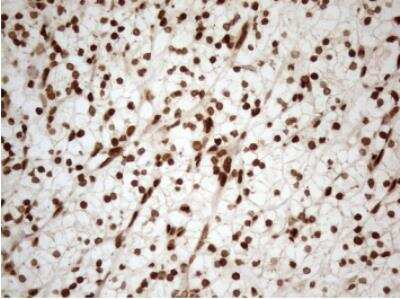 Immunohistochemistry-Paraffin: 5-Lipoxygenase Antibody (OTI3F1) [NBP2-46513]