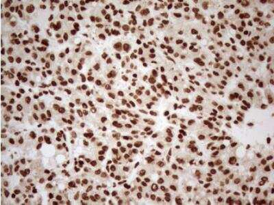Immunohistochemistry-Paraffin: 5-Lipoxygenase Antibody (OTI3F1) [NBP2-46513]
