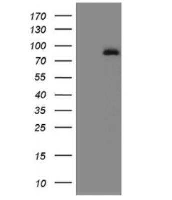 Western Blot: 5-Lipoxygenase Antibody (OTI3F1) [NBP2-46513]