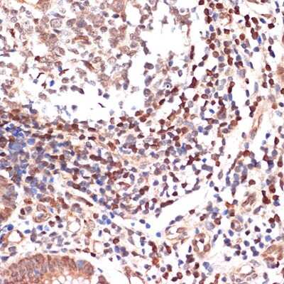 Immunohistochemistry-Paraffin: 5-Lipoxygenase Antibody (5C5Z2) [NBP3-16150]