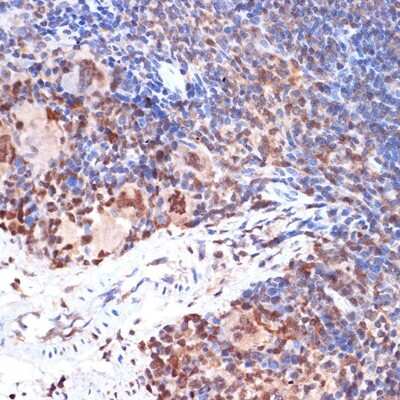 Immunohistochemistry-Paraffin: 5-Lipoxygenase Antibody (5C5Z2) [NBP3-16150]