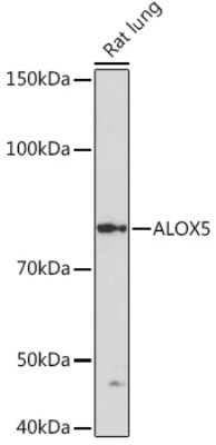 Western Blot: 5-Lipoxygenase Antibody (5C5Z2) [NBP3-16150]