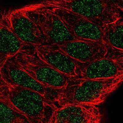 Immunocytochemistry/ Immunofluorescence: 5-Lipoxygenase Antibody [NBP2-56011]