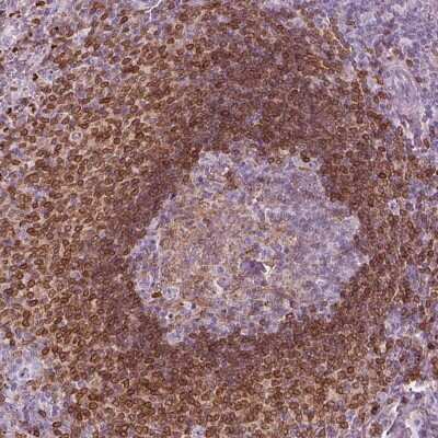 Immunohistochemistry-Paraffin: 5-Lipoxygenase Antibody [NBP2-56011]