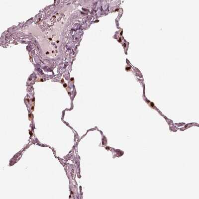 Immunohistochemistry-Paraffin: 5-Lipoxygenase Antibody [NBP2-56011]
