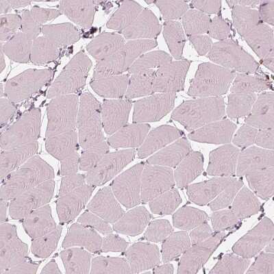 Immunohistochemistry-Paraffin: 5-Lipoxygenase Antibody [NBP2-56011]