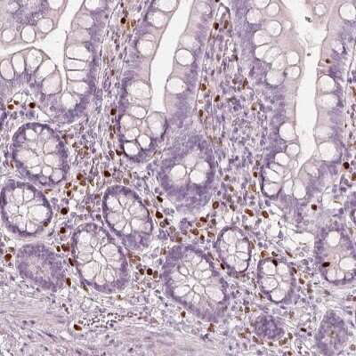 Immunohistochemistry-Paraffin: 5-Lipoxygenase Antibody [NBP2-56011]