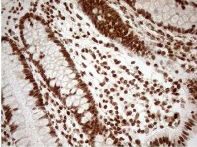 Immunohistochemistry: 5-Lipoxygenase Antibody (OTI3F1) - Azide and BSA Free [NBP2-70166]