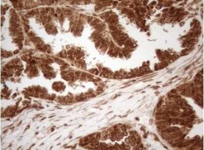 Immunohistochemistry: 5-Lipoxygenase Antibody (OTI3F1) - Azide and BSA Free [NBP2-70166]