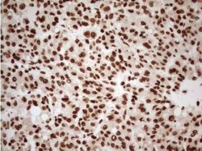 Immunohistochemistry: 5-Lipoxygenase Antibody (OTI3F1) - Azide and BSA Free [NBP2-70166]