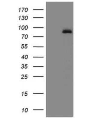 Western Blot: 5-Lipoxygenase Antibody (OTI3F1)Azide and BSA Free [NBP2-70166]