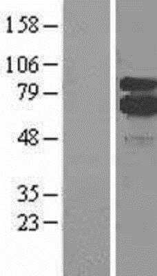 Western Blot: 5-Lipoxygenase Overexpression Lysate [NBL1-07483]