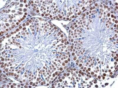 Immunohistochemistry-Paraffin: 5-MethylCytosine Antibody (4111) [NBP2-42814]