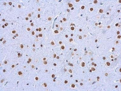 Immunohistochemistry-Paraffin: 5-MethylCytosine Antibody (4111) [NBP2-42814]