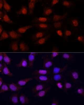 Immunocytochemistry/ Immunofluorescence: 5-Methylcytidine Antibody - BSA Free [NBP3-05669]