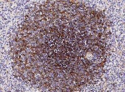 Immunohistochemistry-Paraffin: 5'-Nucleotidase/CD73 Antibody (001) [NBP2-89705]