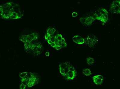 Immunocytochemistry/ Immunofluorescence: 5'-Nucleotidase/CD73 Antibody (102) [NBP2-89706]