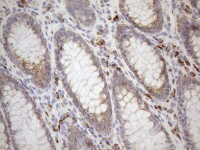 Immunohistochemistry: 5'-Nucleotidase/CD73 Antibody (OTI1G2) [NBP2-46259]