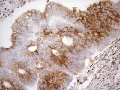 Immunohistochemistry: 5'-Nucleotidase/CD73 Antibody (OTI1G2) [NBP2-46259]