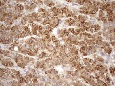 Immunohistochemistry: 5'-Nucleotidase/CD73 Antibody (OTI1G2) [NBP2-46259]