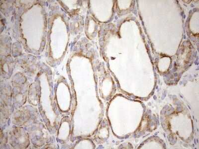 Immunohistochemistry: 5'-Nucleotidase/CD73 Antibody (OTI1G2) [NBP2-46259]