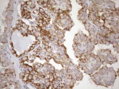 Immunohistochemistry: 5'-Nucleotidase/CD73 Antibody (OTI1G2) [NBP2-46259]