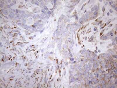Immunohistochemistry: 5'-Nucleotidase/CD73 Antibody (OTI1G2) [NBP2-46259]