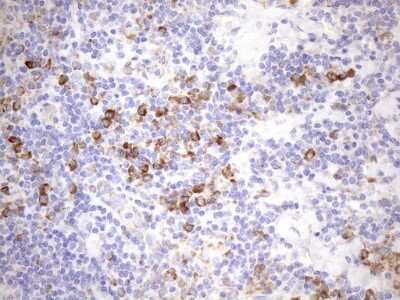 Immunohistochemistry: 5'-Nucleotidase/CD73 Antibody (OTI1G2) [NBP2-46259]