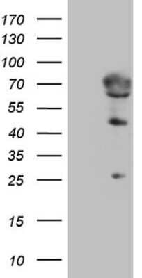 Western Blot: 5'-Nucleotidase/CD73 Antibody (OTI1G2) [NBP2-46259]