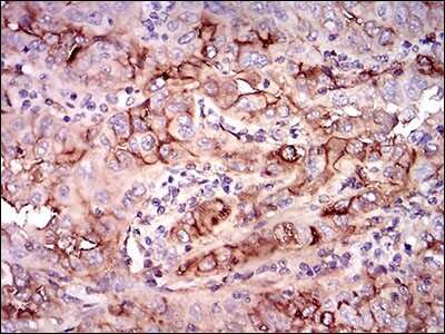Immunohistochemistry-Paraffin: 5'-Nucleotidase/CD73 Antibody (4G6E3) - BSA Free [NBP2-37271]