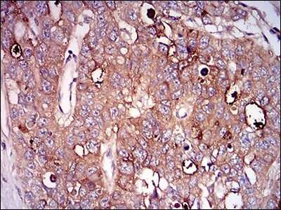 Immunohistochemistry: 5'-Nucleotidase/CD73 Antibody (4G6E3) - BSA Free [NBP2-37271]