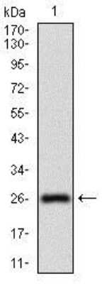 Western Blot: 5'-Nucleotidase/CD73 Antibody (4G6E3)BSA Free [NBP2-37271]