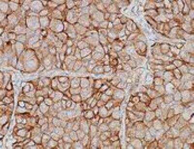 Immunohistochemistry-Paraffin: 5'-Nucleotidase/CD73 Antibody (AD2) - BSA Free [NBP2-48480]