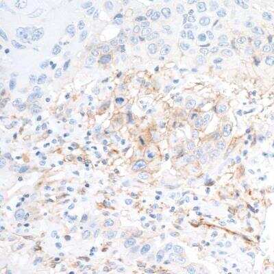 Immunohistochemistry: 5'-Nucleotidase/CD73 Antibody (BLR054F) [NBP3-14679]
