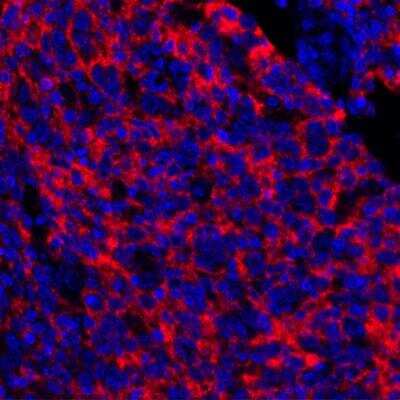 Immunohistochemistry: 5'-Nucleotidase/CD73 Antibody (BLR054F) [NBP3-14679]