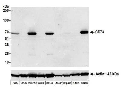 Western Blot: 5'-Nucleotidase/CD73 Antibody (BLR054F) [NBP3-14679]