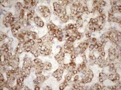Immunohistochemistry: 5'-Nucleotidase/CD73 Antibody (OTI1G2) - Azide and BSA Free [NBP2-71214]