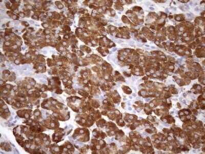 Immunohistochemistry: 5'-Nucleotidase/CD73 Antibody (OTI1G2) - Azide and BSA Free [NBP2-71214]
