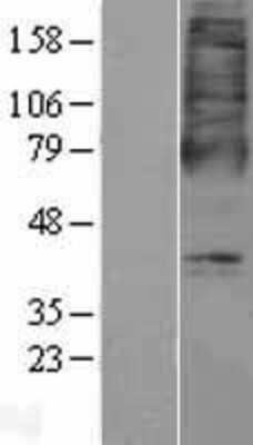 Western Blot: OXER1/5-oxo-ETE GPCR Overexpression Lysate [NBP2-04425]