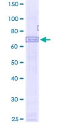 Western Blot: Recombinant Human AIM2 GST (N-Term) Protein [H00009447-P01]