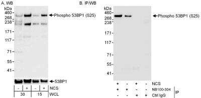 Western Blot: 53BP1 [p Ser25] Antibody [NB100-1803]