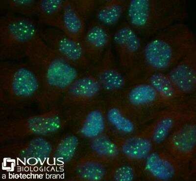 Immunocytochemistry/Immunofluorescence Staining of 53BP1 in A431 Cells Using Conjugated Antibody