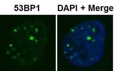 Immunocytochemistry/ Immunofluorescence: 53BP1 Antibody - BSA Free [NB100-904]